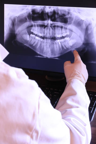 Best Same-Day Emergency Dentist in Mccullom Lake, IL