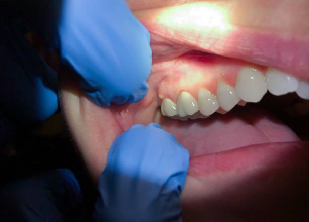 Best 24-Hour Emergency Dentist in Mccullom Lake, IL
