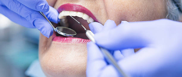 Best Emergency Tooth Extraction in Mccullom Lake, IL